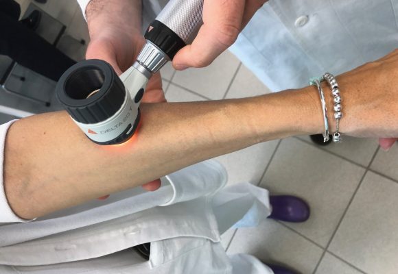 Progetto Prosantè – Dermatologia: a Oulx il “paziente zero”